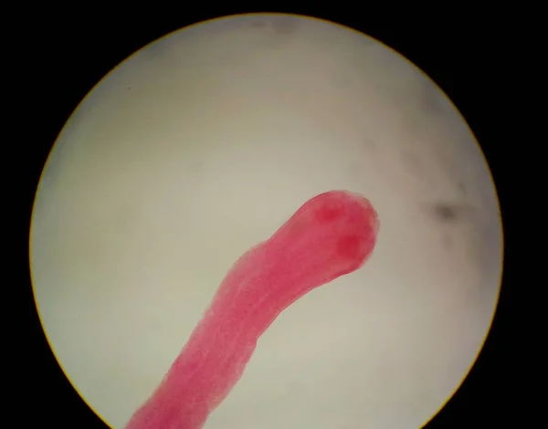 Detailní záběr vejce s dospělého parazita. — Stock fotografie