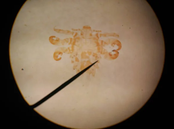 Makro djur parasit hitta med Mikroskop. — Stockfoto