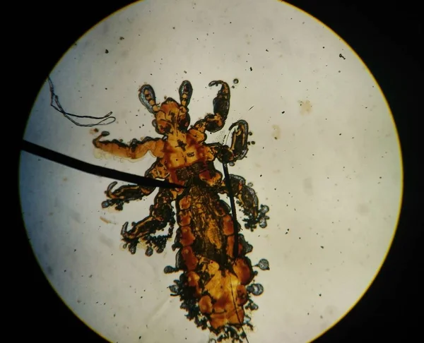 Najít makro zvířecích parazitů pod mikroskopem. — Stock fotografie