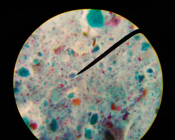Ovo Perto Com Adulto Parasita Encontrado Com Microscópio Parasitologia — Fotografia de Stock