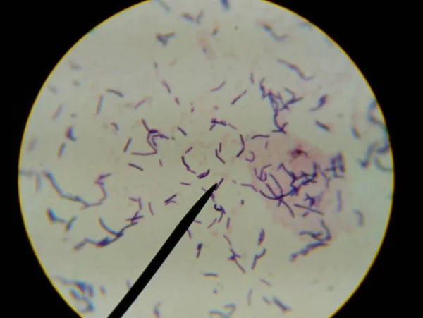 Hallazgo de células bacterianas con microscopio . — Foto de Stock