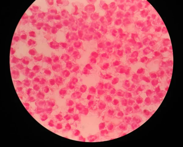 Latar belakang ilmu kedokteran sel darah putih . — Stok Foto