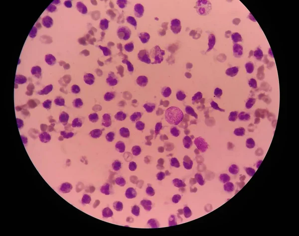 Witte bloedcellen medische wetenschap achtergrond. — Stockfoto