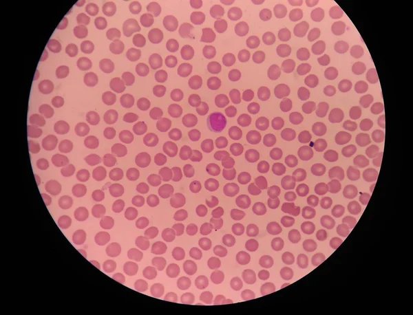 Ερυθρά αιμοσφαίρια ιατρική επιστήμη φόντο. — Φωτογραφία Αρχείου