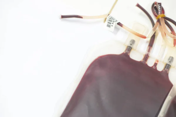 Bloed tas in laboratorium. — Stockfoto