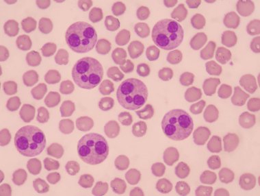 Neutrophil with red blood cells. clipart