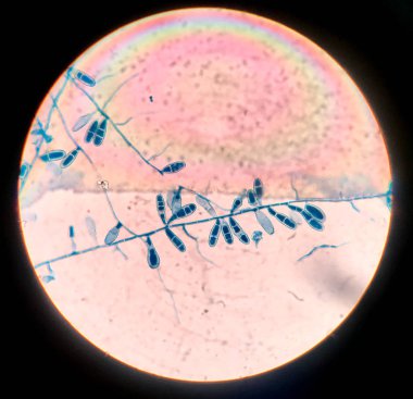 Close up macro conidia of fungi. clipart