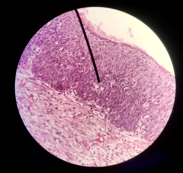 Zellen in reproduktiver weiblicher Zytologie und Histologie. — Stockfoto