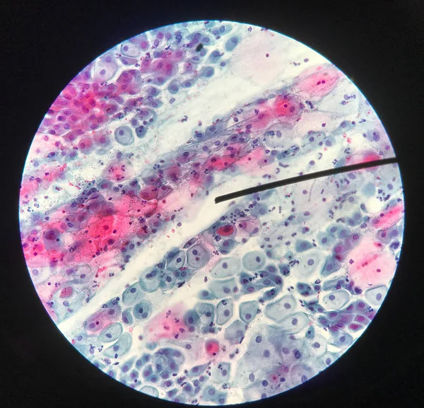 Celule în citologia reproductivă feminină și conceptul de histologie . — Fotografie, imagine de stoc