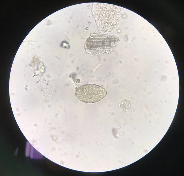 Huevo parásito humano en el examen de las heces . —  Fotos de Stock