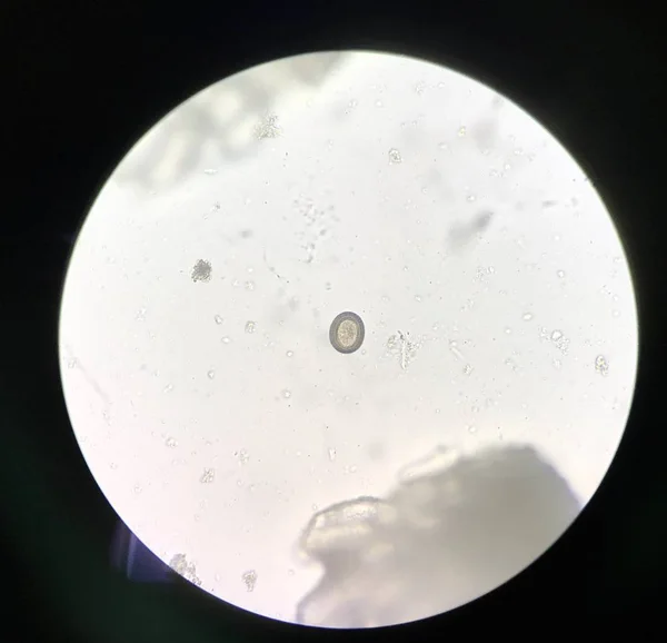 Яичный паразит человек при обследовании стула . — стоковое фото