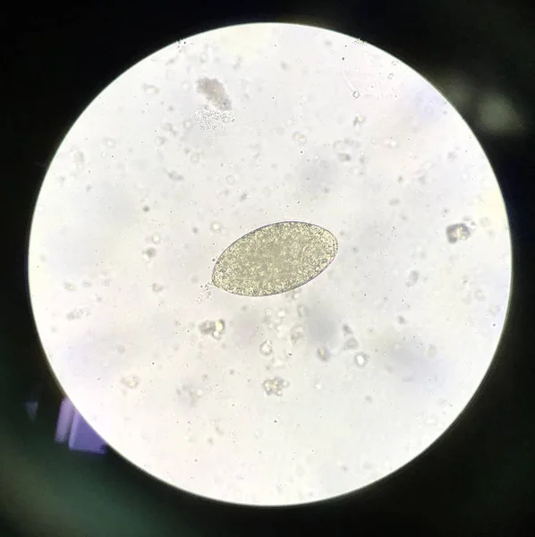 Huevo parásito humano en el examen de las heces . —  Fotos de Stock