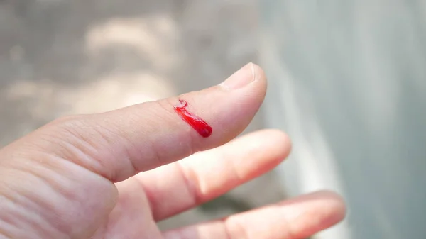 Čerstvá rána s krví v prstu. — Stock fotografie