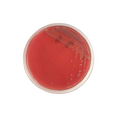 Medya kültür bakterilerini kapat.