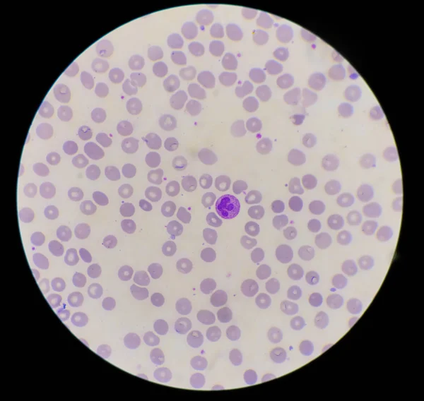 Neutropil with toxic granulation on red blood cells background. — ストック写真