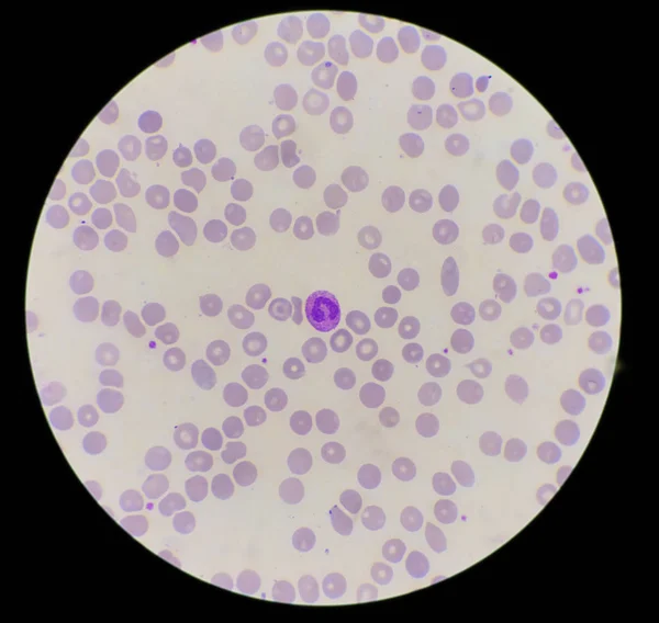 Neutropil with toxic granulation on red blood cells background. — ストック写真