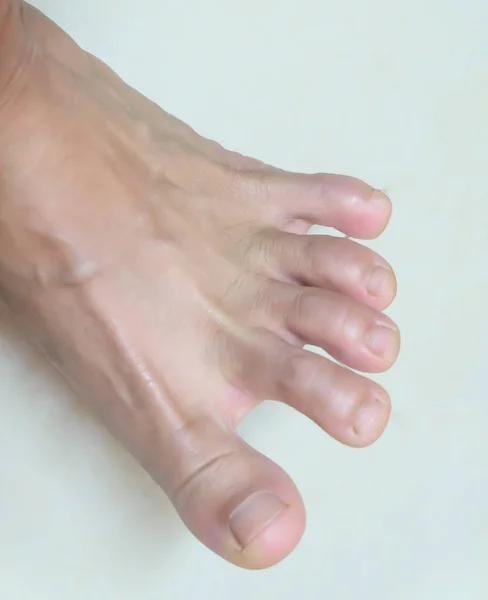 Close up foot on floor. — 스톡 사진