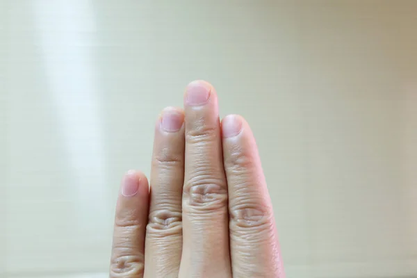 Nahaufnahme der Hand auf verschwommenem Hintergrund. — Stockfoto