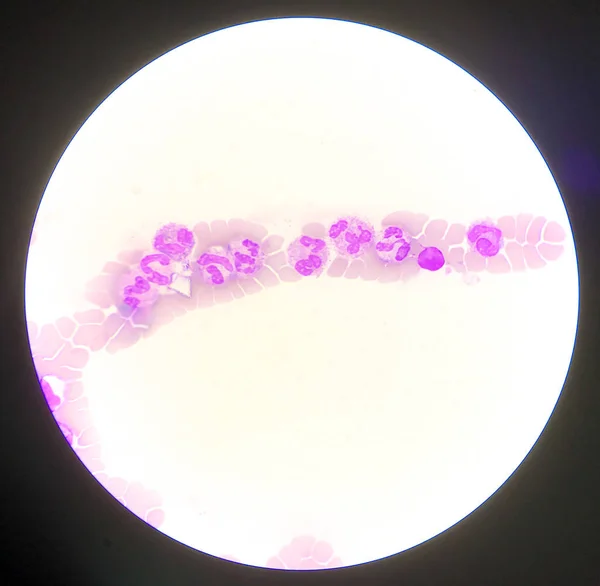 Neutrophile weiße Blutkörperchen auf rotem Blutkörperchenhintergrund. — Stockfoto