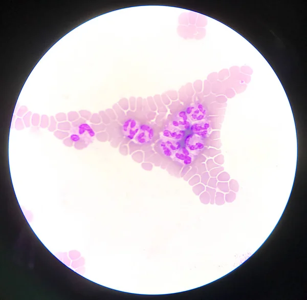 Neutrophile weiße Blutkörperchen auf rotem Blutkörperchenhintergrund. — Stockfoto