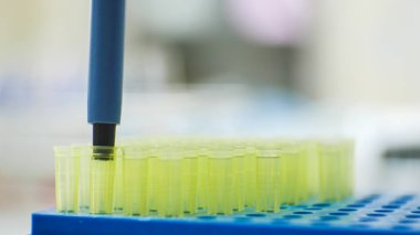 Mavi kutuda sarı pipet ucu.