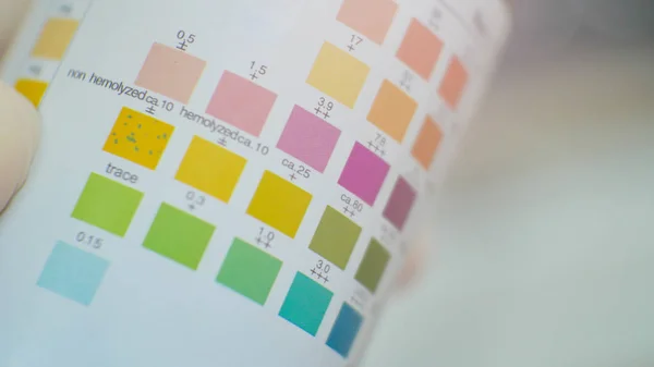 Close up color level in urine strip test. — 스톡 사진