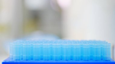 Kutudaki bulanık pipet uçları.