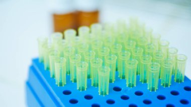 Kutudaki bulanık pipet uçları.
