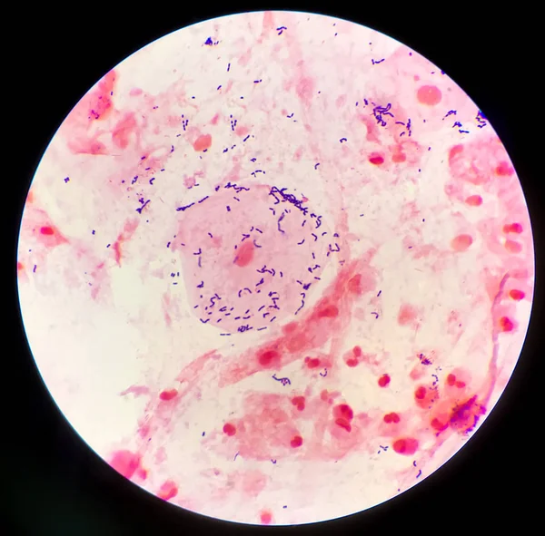 Gram bacilli positivi su sfondo rosso . — Foto Stock