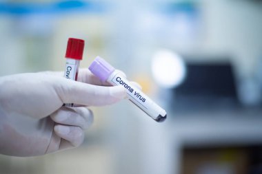 Kan koronavirüsünün test tüpünü kapat..