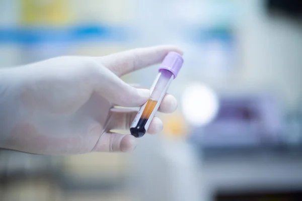 Kan Koronavirüsünün Test Tüpünü Kapat — Stok fotoğraf