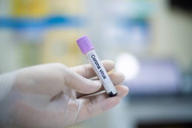Kan koronavirüsünün test tüpünü kapat..