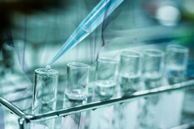 Teşhis koronavirüsü veya covid-19 virüsünde çift pozlama laboratuvar geçmişi.