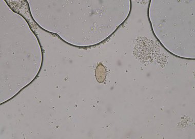 Dışkı testinde mikroskopla bulunan parazit yumurtası..
