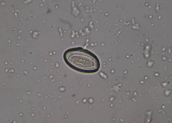 Œuf Parasite Dans Les Selles Résultats Des Tests Examen Microscope — Photo