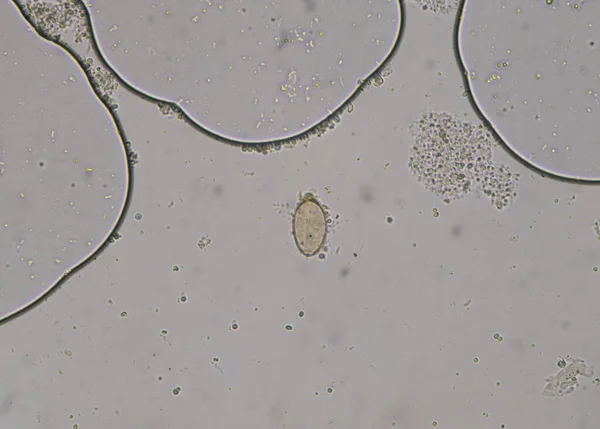 Huevo Parásito Prueba Examición Heces Hallazgo Con Microscopio — Foto de Stock