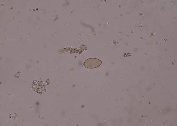 Huevo Parásito Prueba Examición Heces Hallazgo Con Microscopio — Foto de Stock