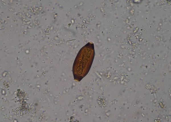 Uova Parassita Nei Test Esame Delle Feci Con Microscopio — Foto Stock
