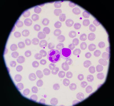 Kırmızı kan hücreleri ve beyaz kan hücreleri laboratuvar konsepti.