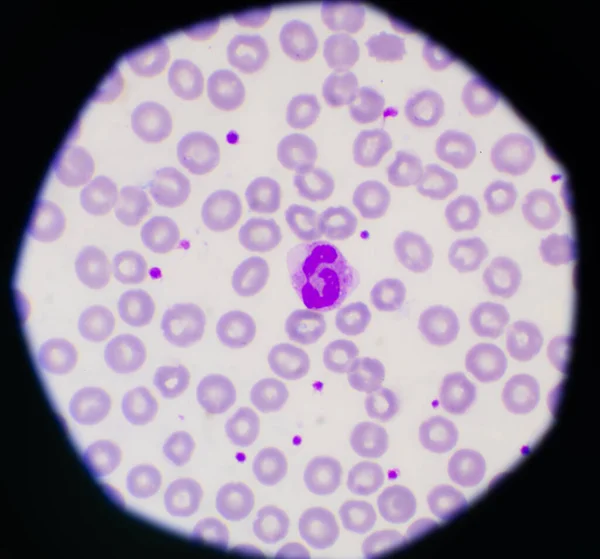 红血球和白血球背景实验室概念 — 图库照片
