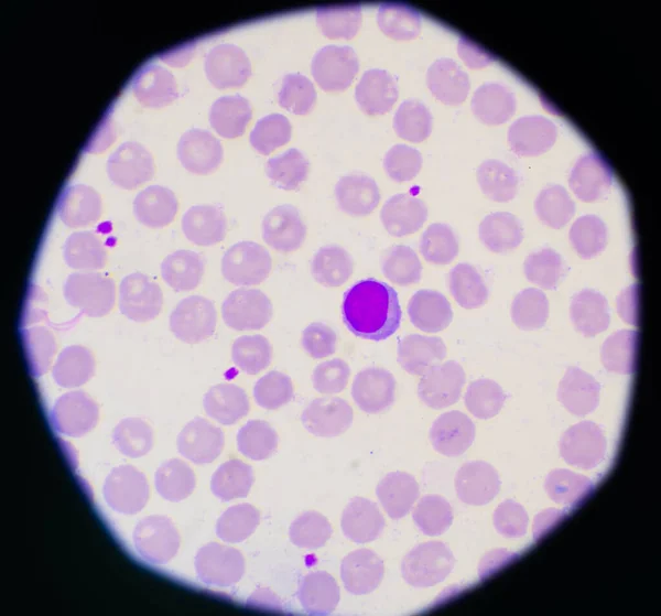 Ερυθρά Αιμοσφαίρια Και Λευκά Αιμοσφαίρια — Φωτογραφία Αρχείου