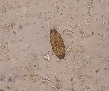 Dışkı muayenehanesi konseptinde yumurta paraziti.