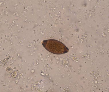 Dışkı muayenehanesi konseptinde yumurta paraziti.