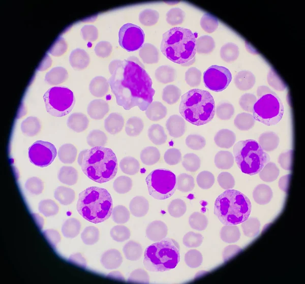 正常な赤血球背景実験室の概念 — ストック写真