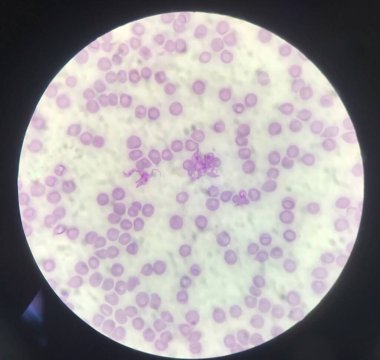 Kan paraziti. Kırmızı kan hücreleri üzerinde Trypanosoma. Tıbbi geçmiş konsepti..