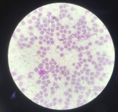 Kan paraziti. Kırmızı kan hücreleri üzerinde Trypanosoma. Tıbbi geçmiş konsepti..