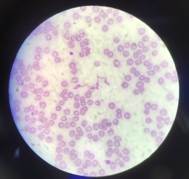 Kan paraziti. Kırmızı kan hücreleri üzerinde Trypanosoma. Tıbbi geçmiş konsepti..