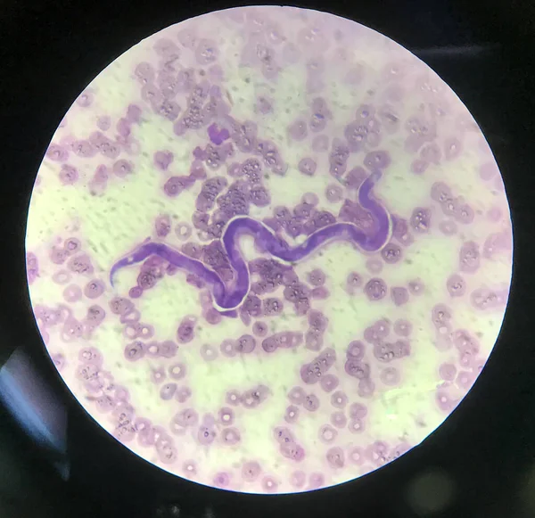 Паразитарная Микрофилярия Крови Фоне Эритроцитов — стоковое фото