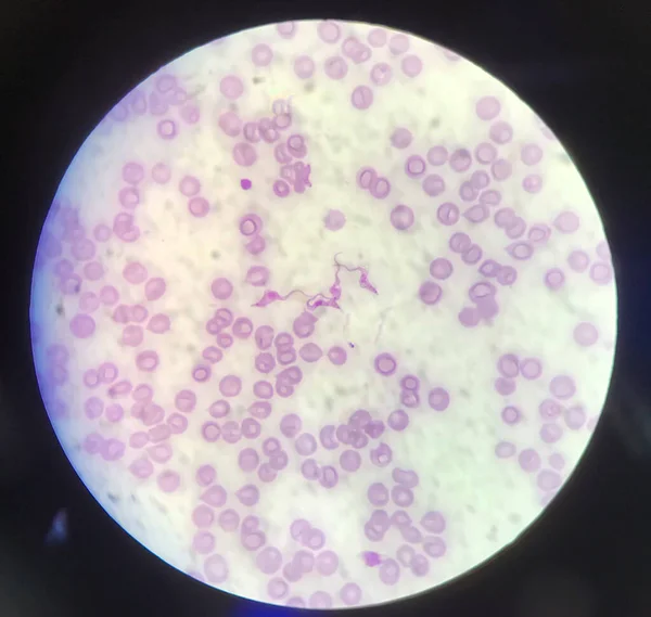 Blood Parazita Trypanosoma Vörösvértestek Orvosi Háttér Koncepció — Stock Fotó