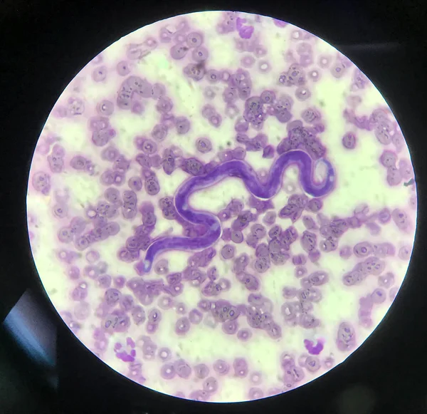 赤血球上の血液寄生虫マイクロフィリア背景 ストック写真